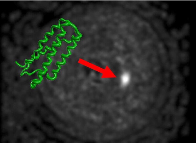A photo of a protein.