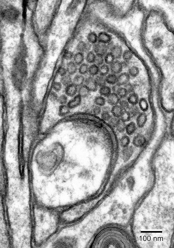 Electron Tomography - Synapse in Substantia Nigra