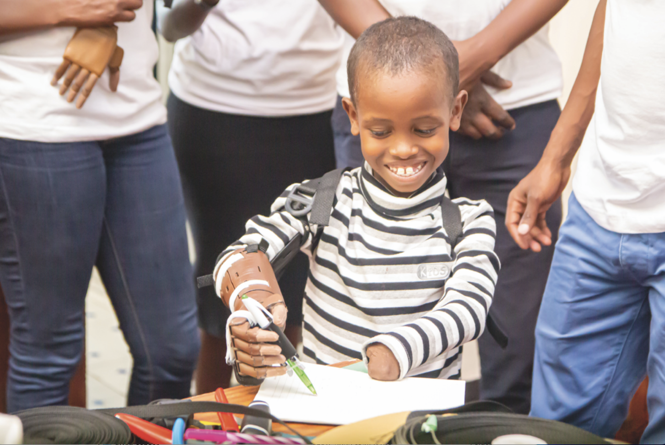 Young boy with prosthetic hand