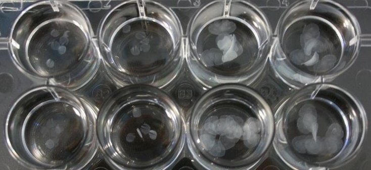 Brain Tissue Slices