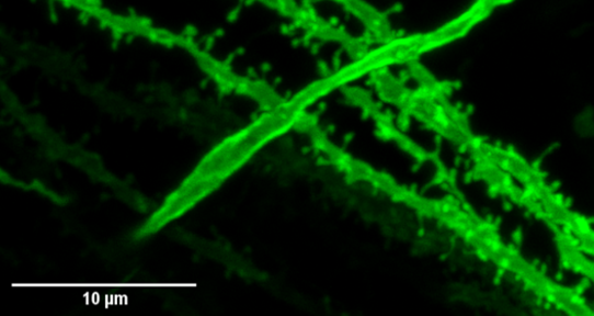 Dentate Gyrus Granule cell dendrites from female rat stained with DiI Crystals.