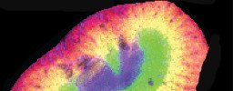mass spectrometry image of kidney cells