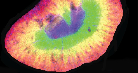 mass spectrometry image of a kidney
